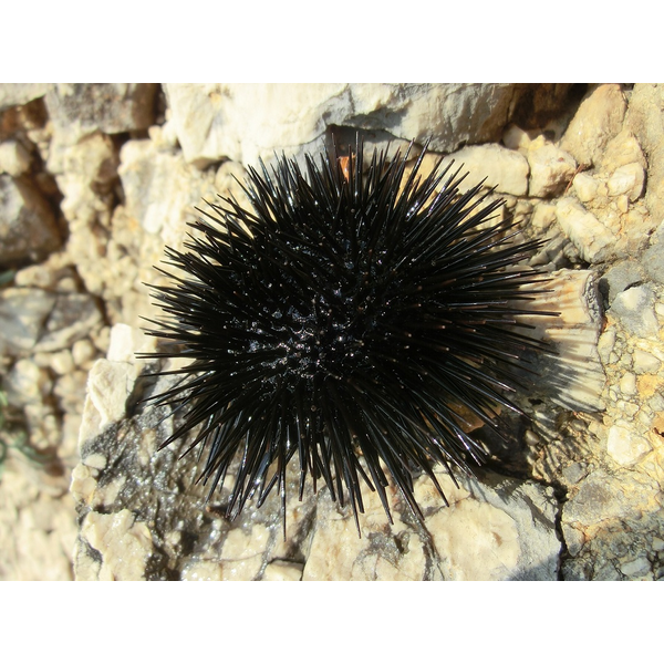 クミタス 読み物 ウニによるアレルギー